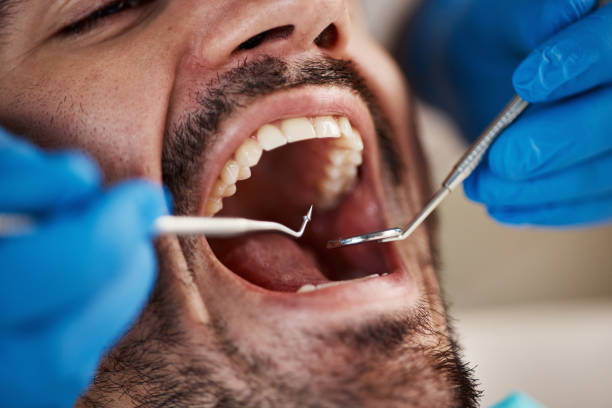 Best Emergency Root Canal Treatment in Sandoval, IL