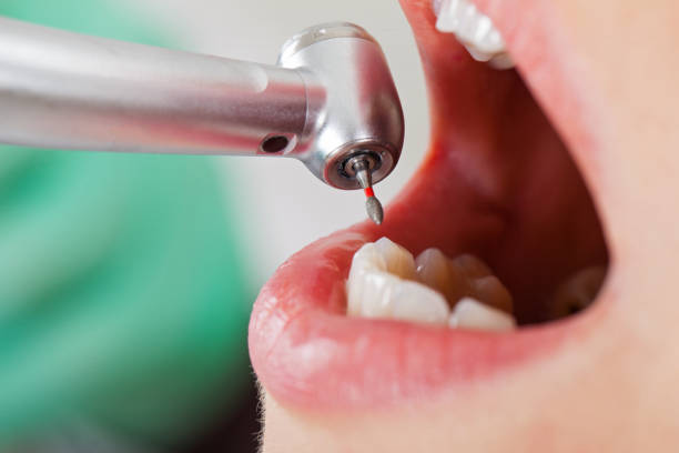 Best Weekend Emergency Dentist in Sandoval, IL